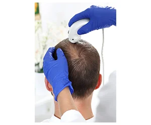 Personalized Hair Restoration Options: Free Analysis at MD Hair Transplant Center